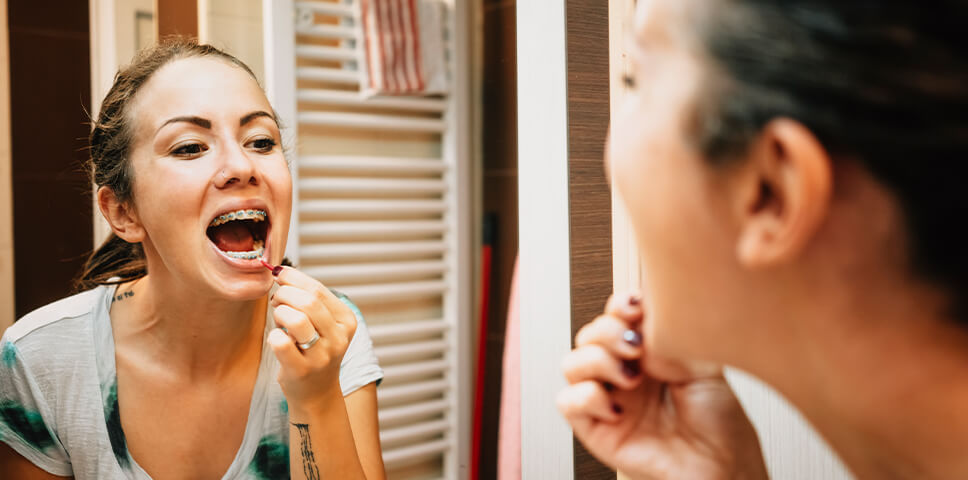 Keep Your Braces and Invisalign® On-Track in Melbourne This Winter